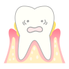 periodontosis_mechanism03